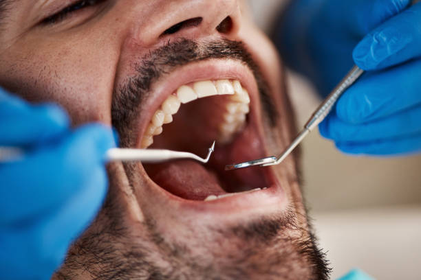 Best Broken Tooth Emergency  in Broadview Park, FL